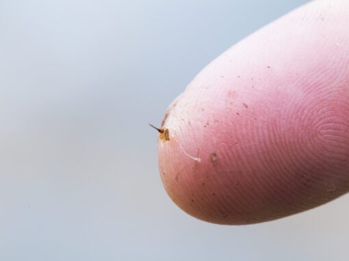 honey bee stinger in finger